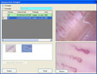 Global Medical Data