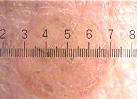 Skin detail on the screen