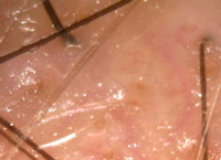Skin detail on the screen