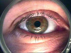 Examples in the ophthalmic sector