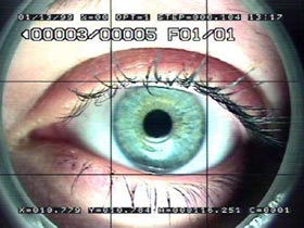 Examples in the ophthalmic sector