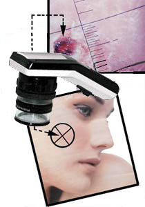 Derma Vision